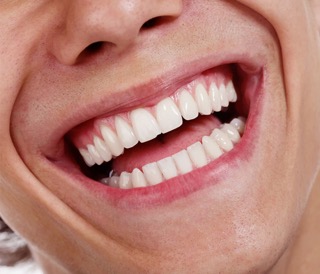ortodoncia-madrid-sonrisa-alineada