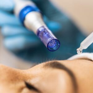 dermapen clinicas doctor franco